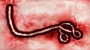 Enfermera británica con ébola en estado crítico 