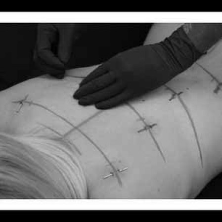 Debido a que la curación de múltiples piercings a la vez es bastante estresante para el cuerpo, la mayoría de las personas optan por llevar piercings corsé temporales.