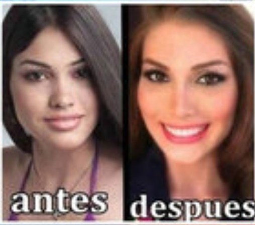 María Gabriela Isler dijo “éramos feos todos” de pequeños, pero que no se había hecho cirugías en su cara, admitiendo que sí era ella la de la foto.<br /><br /> Primeras fotos de Gabriela Isler<br /><br />