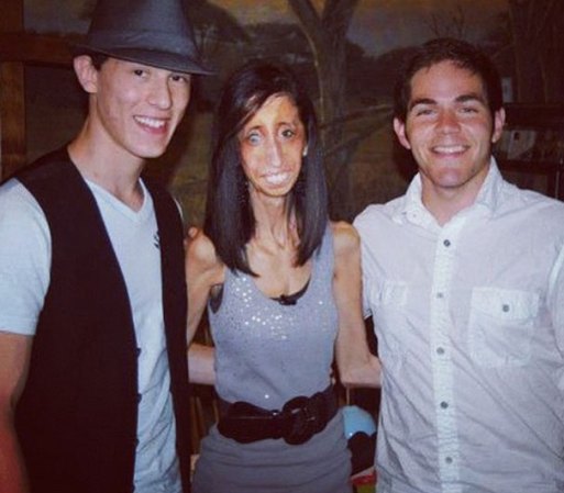 Septiembre 20, 2012 - Lizzie Velasquez, sufre de una rara enfermedad, que en lugar de acomplejarla, le da fortaleza para conocerse a sí misma y brindarse a los demás.