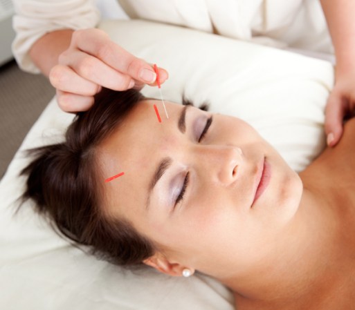 La acupuntura es una técnica que cada vez logra más adeptos. Vale la pena probarla. Para obtener una lista de doctores que realizan acupuntura, llame a la American Academy of Medical Acupuncture al 323-937-5514 o visite su sitio Web en www.medicalacupuncture.org.