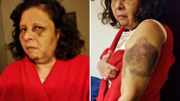 Empleada denuncia brutal tortura en Queens