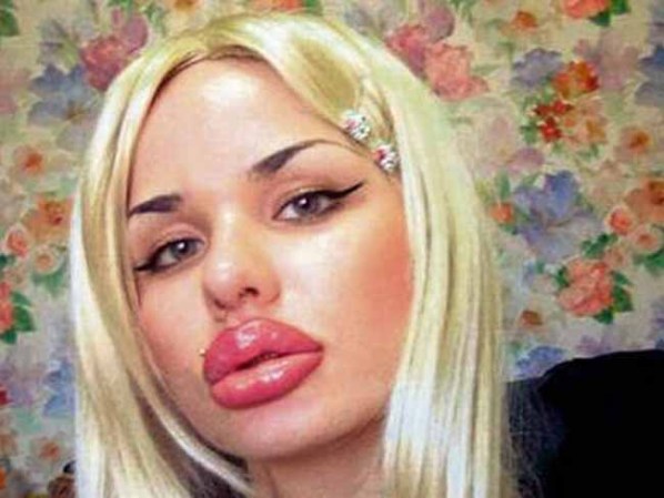 Kristina Rei, una chica rusa de San Petersburgo, de 22 años, posee los labios más grandes del mundo después de 100 inyecciones de silicona.