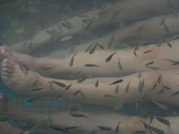 Los doctores no son ni más ni menos que peces de agua dulce, que se comen el tejido enfermo o muerto de la piel.