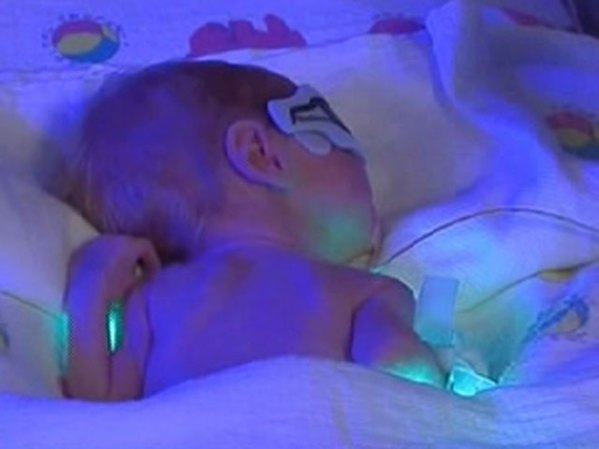 En tanto, Suleman fue dada de alta la mañana del jueves con total discreción. Muy temprano salió del Centro Médico Kaiser Permanente Bellflower, dijo Nancy Tovar-Huxen, portavoz del nosocomio. La vocera no suministró ninguna otra información "con base al hecho de que la mamá pidió privacidad".