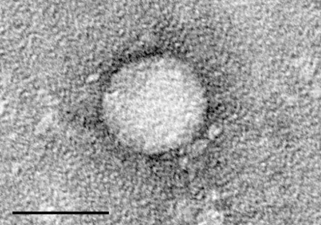 Hepatitis C. Provoca hinchazón (inflamación) del hígado. Puede contraer este tipo de hepatitis si la sangre de alguien con hepatitis C ingresa a tu cuerpo por medio de agujas contaminadas o por una cortada en la piel, ojos o boca.