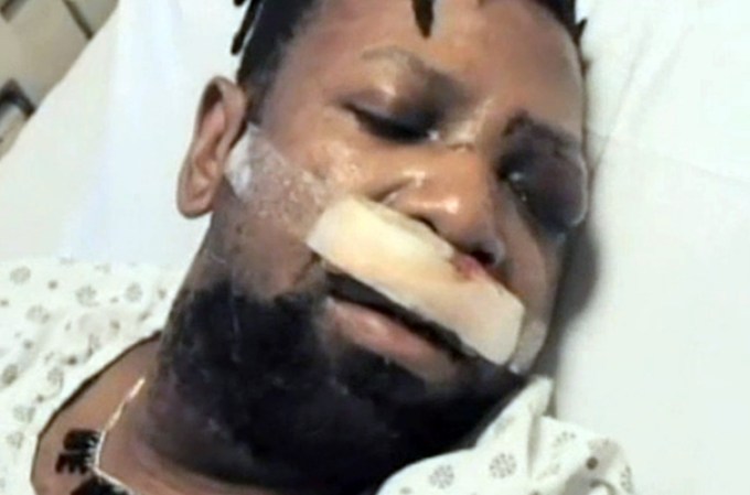 Barnes recibe medicamentos en el hospital.