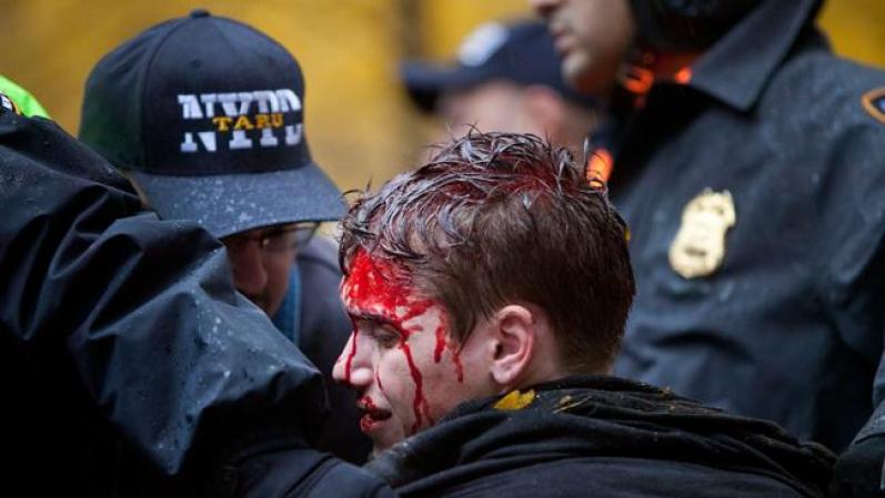 Occupy Wall Street: En septiembre de 2011 se formó el movimiento de protesta en la ciudad de Nueva York y se extendió a múltiples ciudades y países, en una lucha contra el sistema económico actual. En esta imagen, un joven resultó herido en Nueva York tras un enfrentamiento entre protestantes y la policía.