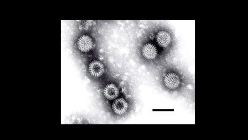 Rotavirus. Es uno de los virus más comunes entre los niños. Causa más de 500,000 muertes al año. Se transmite por contaminación de comida o agua o por contacto con superficies contaminadas.