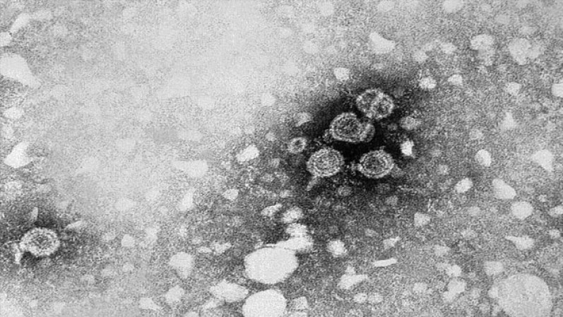 Hepatitis B. El virus, causante de la enfermedad que lleva el mismo nombre, afecta principalmente el hígado. Se estima que en el mundo hay 350 millones de personas que portan el virus.