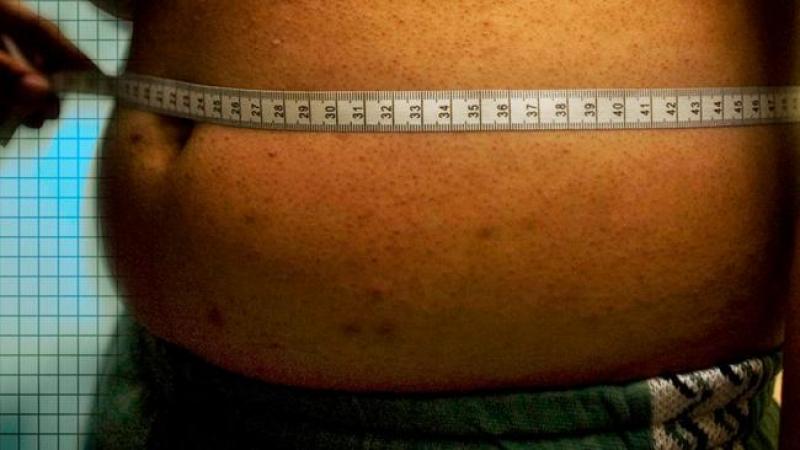 Cirugía pone diabetes en remisión