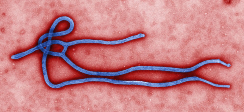 Ébola, se transmite por contacto directo con sangre, líquidos orgánicos o tejidos de las personas infectadas.