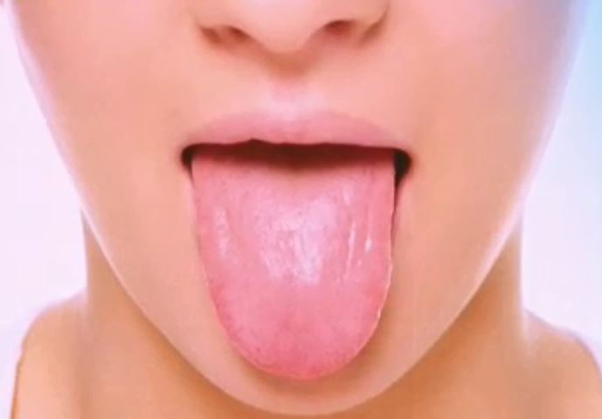 La salud y el color de tu lengua: averigua cómo estás – Telemundo ...