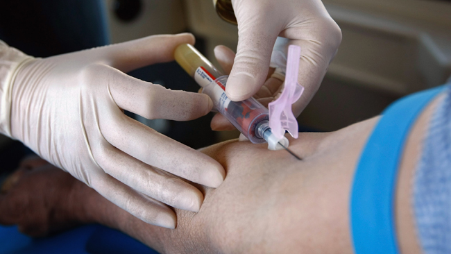 cáncer de próstata actualizado cáncer de próstata actualizado
