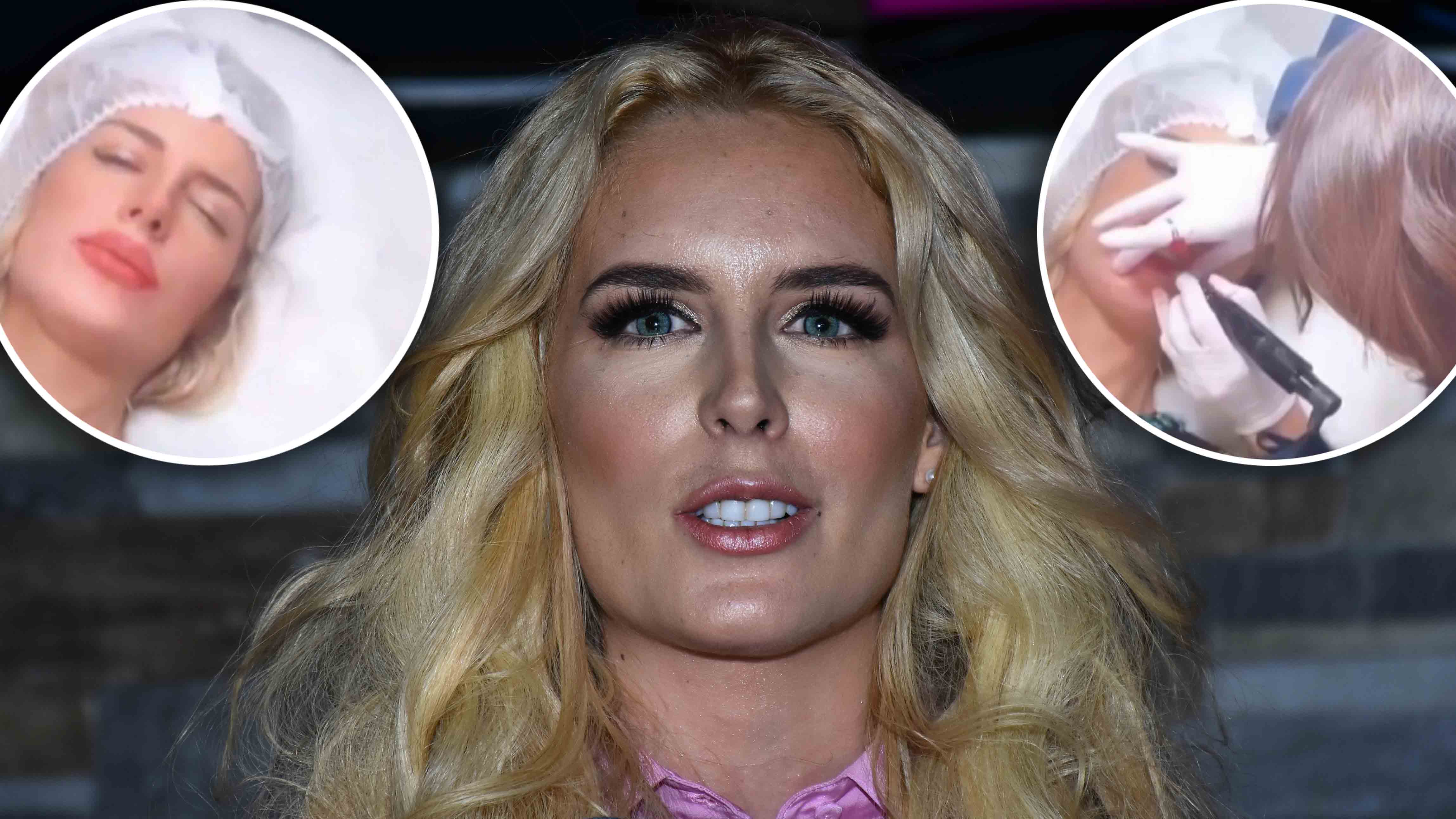 Se tatuó los labios: el doloroso tratamiento de belleza de Tania Ruiz, novia de Peña Nieto – Telemundo Washington DC (44) Se tatuó los labios: el doloroso tratamiento de belleza de Tania Ruiz, novia de Peña Nieto – Telemundo Washington DC (44)