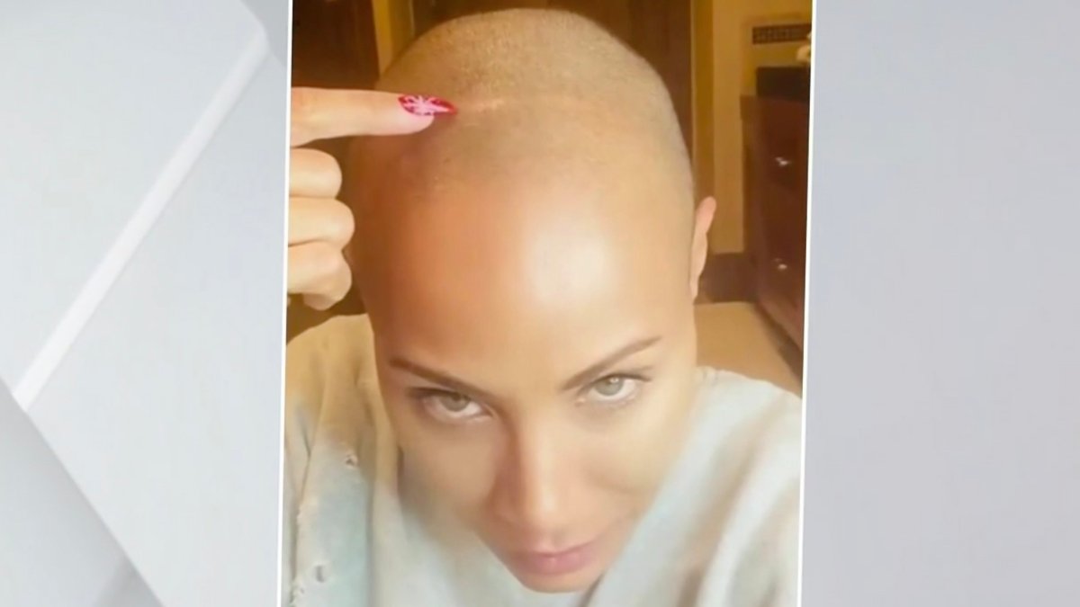 En video: Jada Pinkett Smith muestra los efectos de la alopecia en su