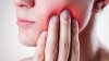 Los peligros de la periodontitis: ¿qué es y cómo prevenir esta enfermedad en las encías?