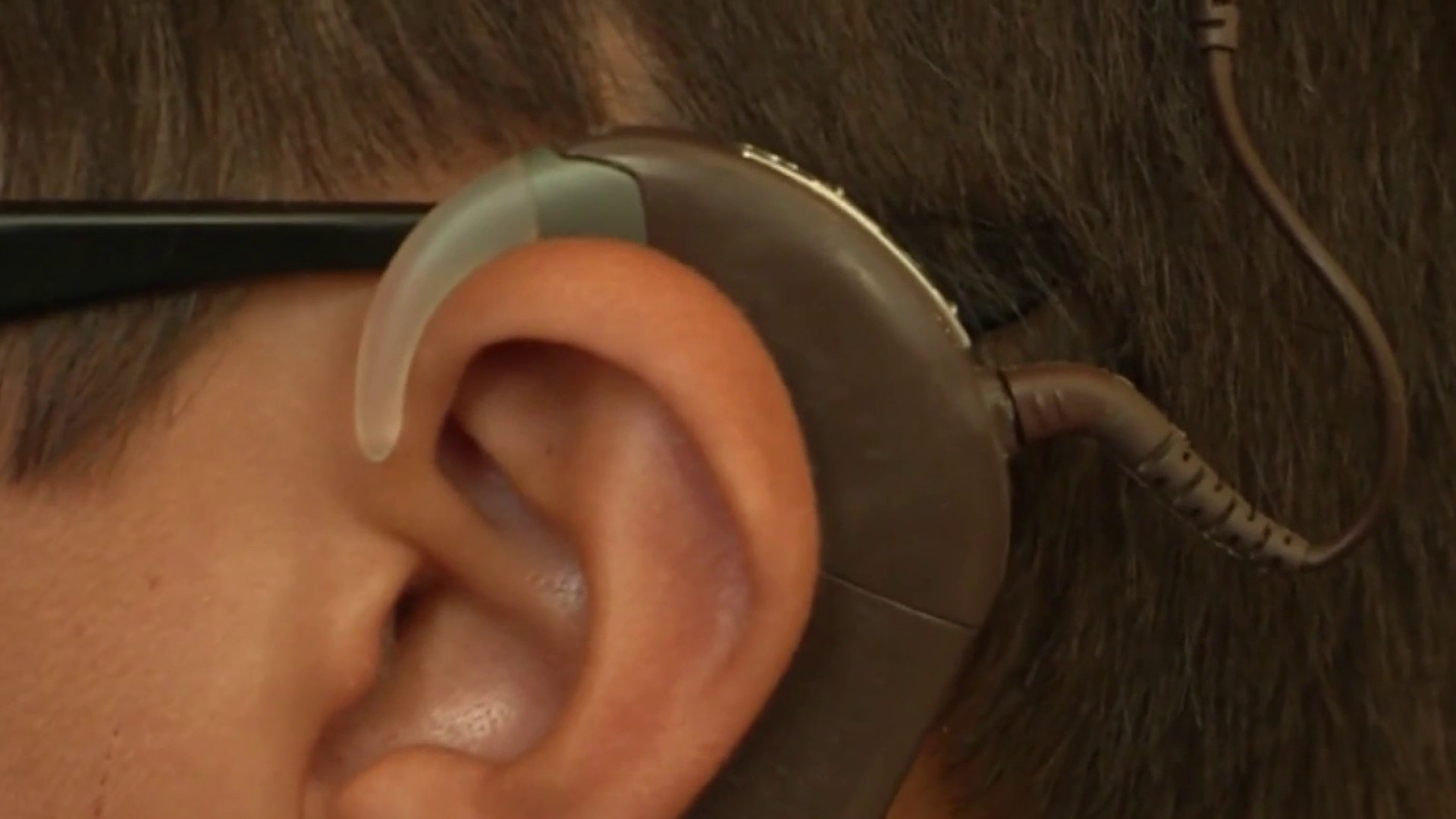 Audífonos para Sordos en Óptica del Notariado 