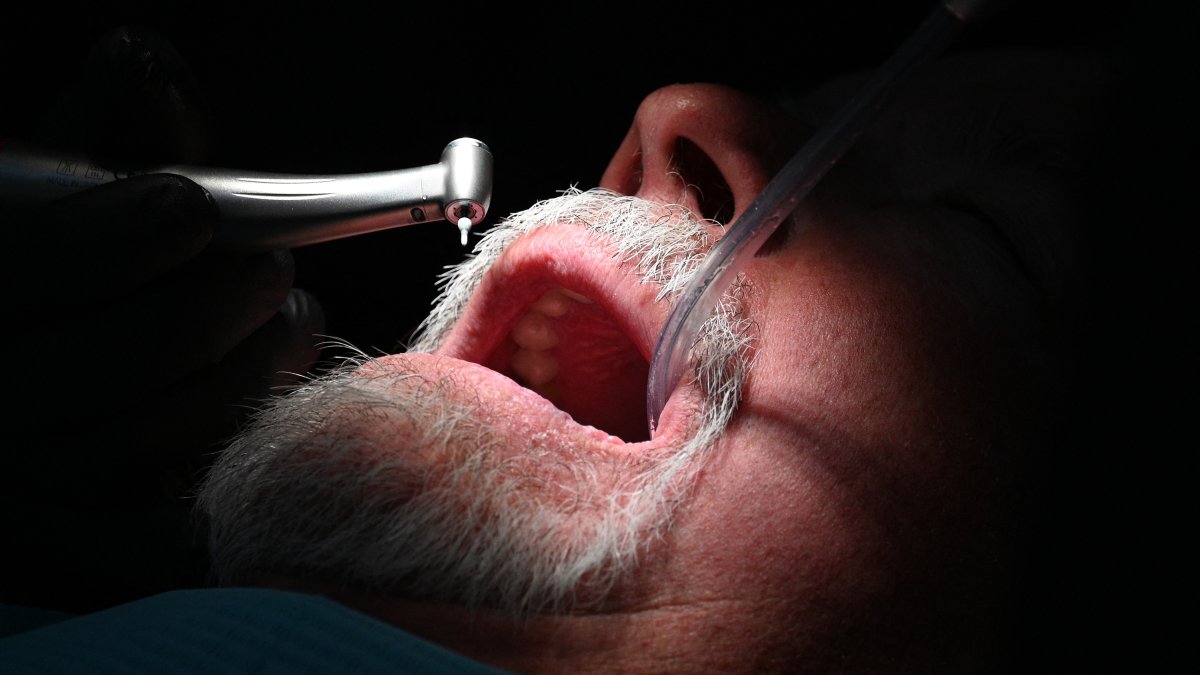 Low-income New Yorkers are now eligible for a root canal in their dental coverage