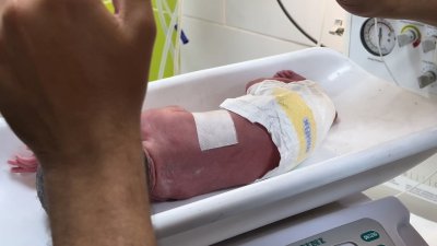 Milagro: bebé palestina nace por cesárea de emergencia tras ataque Israelí