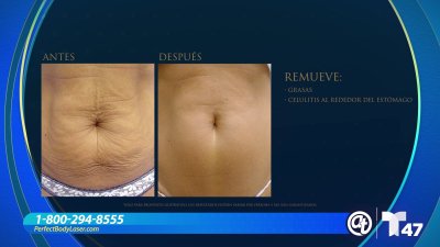 Perfect Body Laser Clinic