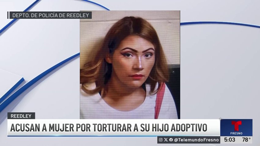 Mujer es acusada de torturar a su hijo adoptivo con agua hirviendo