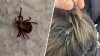 ¿Fiebre del conejo? Reportan casos de rara enfermedad transmitida por garrapatas en Long Island