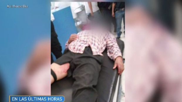 Violencia deja un niño muerto y heridos en Michoacán (IMAGENES FUERTES)