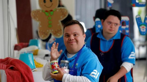 Resultado de imagen de sindrome de down